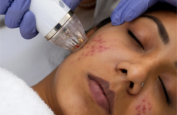 Facial service in Coimbatore Facial service in Coimbatore